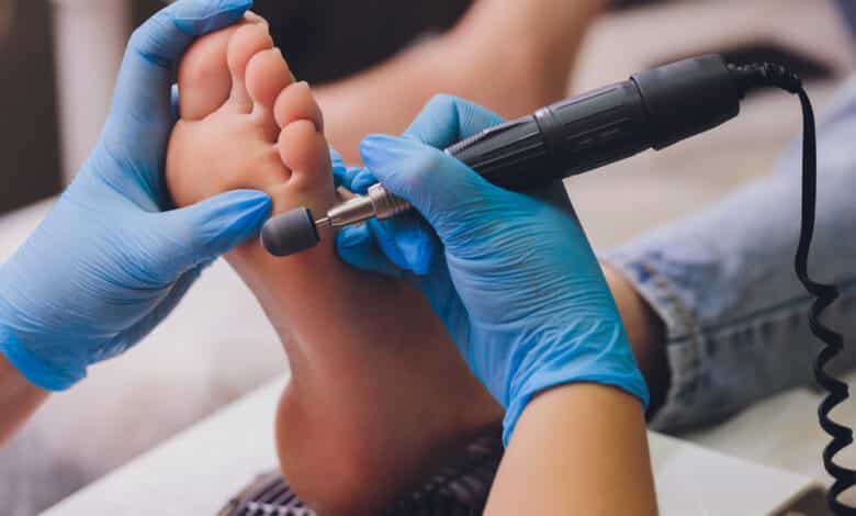 Cosa serve per fare una pedicure perfetta