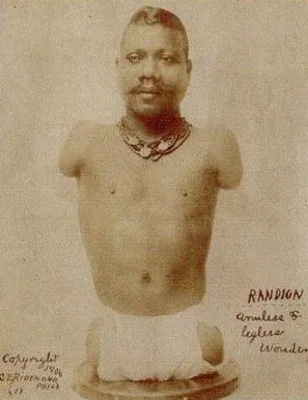 Prince Randian posiert für ein Foto