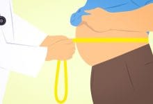 liposuzione